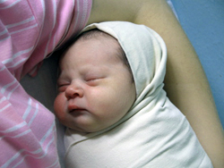 Acid Reflux Symptoms in Newborns